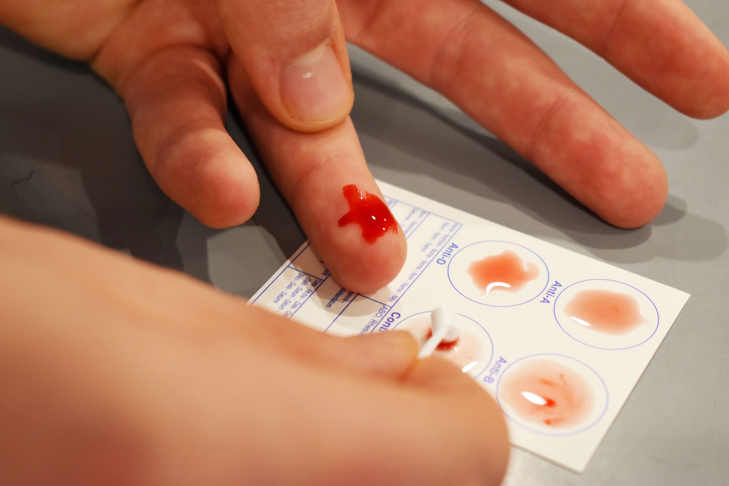 Eleven på HTX, Hansenberg Tekniske Gymnasium er ved at tage en blodprøve til et forsøg.